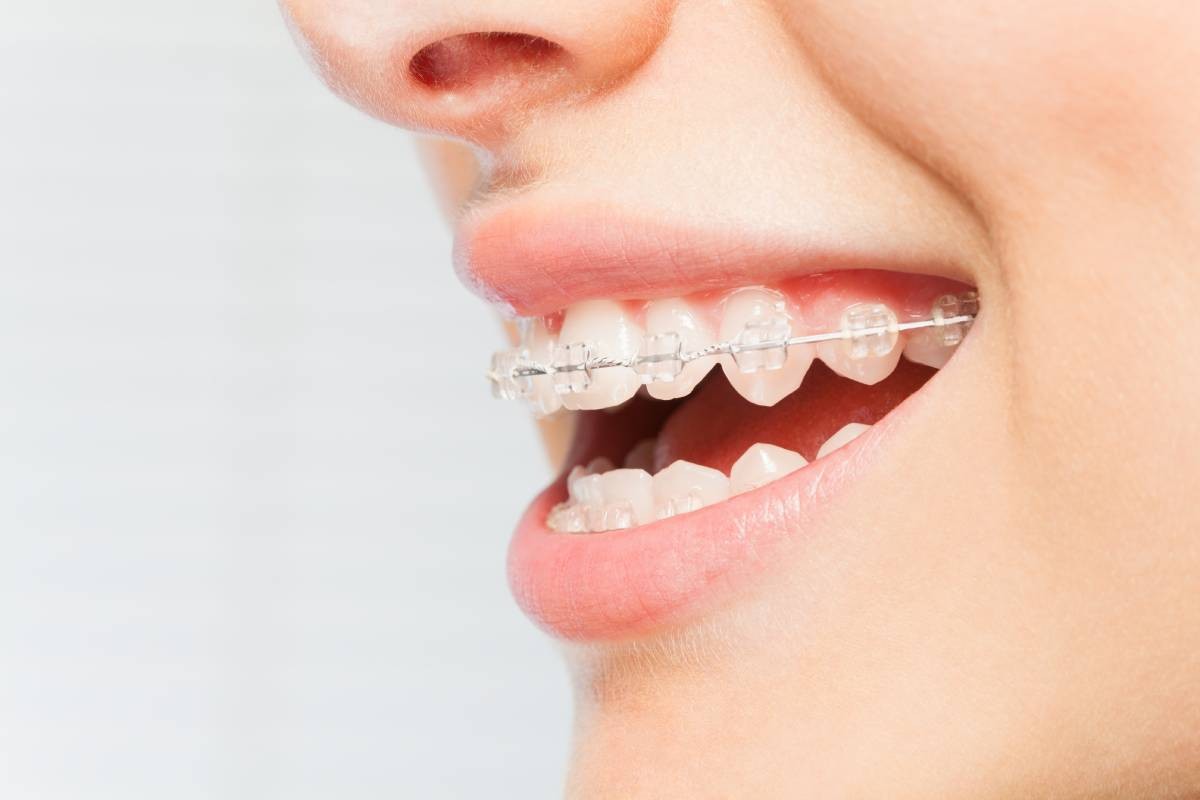 Orthodontic Services Orthodontic Services