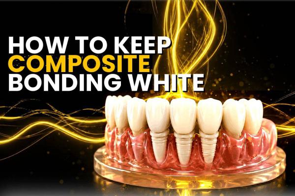 How To Keep Composite Bonding White