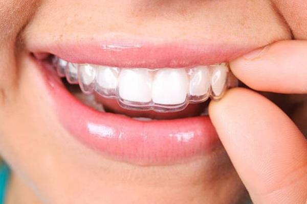 Orthodontic Services
