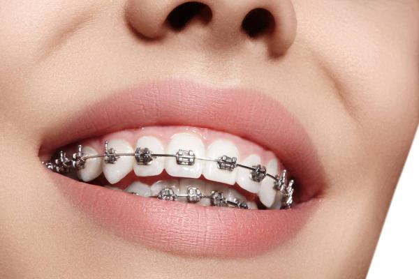 Orthodontic Services