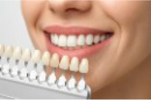 Cosmetic Dentistry