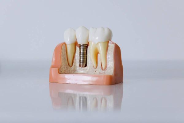 Restorative Dentistry